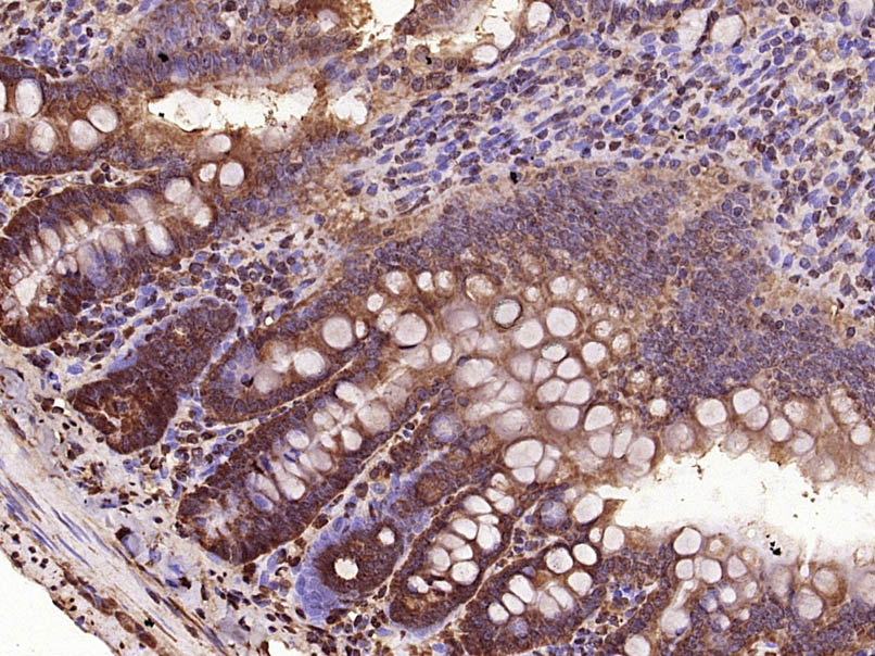 Paraformaldehyde-fixed, paraffin embedded Rat small intestine; Antigen retrieval by boiling in sodium citrate buffer (pH6.0) for 15min; Block endogenous peroxidase by 3% hydrogen peroxide for 20 minutes; Blocking buffer (normal goat serum) at 37°C for 30min; Antibody incubation with VEGF-C Polyclonal Antibody, Unconjugated (bs-1586R) at 1:400 overnight at 4°C, DAB staining.