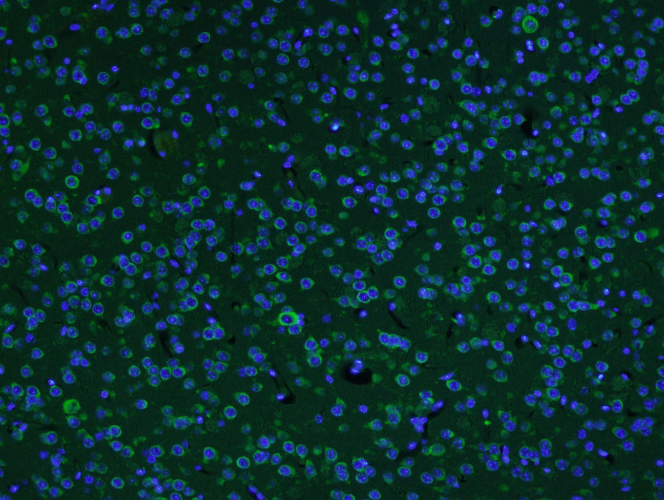 Paraformaldehyde-fixed, paraffin embedded Mouse brain; Antigen retrieval by boiling in sodium citrate buffer (pH6.0) for 15min; Block endogenous peroxidase by 3% hydrogen peroxide for 20 minutes; Blocking buffer (normal goat serum) at 37°C for 30min; Antibody incubation with AKAP12/Gravin Polyclonal Antibody, Unconjugated (bs-1381R) at 1:400 overnight at 4°C, followed by a conjugated Goat Anti-Rabbit IgG antibody (bs-0295G-FITC) for 90 minutes, and DAPI for nuclei staining.