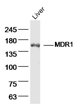 Rat liver lysates probed with MDR1 Polyclonal Antibody, Unconjugated (bs-0563R) at 1:300 dilution and 4˚C overnight incubation. Followed by conjugated secondary antibody incubation at 1:10000 for 60 min at 37˚C.