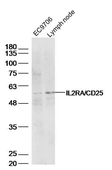 Lane 1: EC9706 lysates; Lane 2: mouse lymph node lysates probed with IL2RA Polyclonal Antibody, Unconjugated (bs-0577R) at 1:500 dilution and 4˚C overnight incubation. Followed by conjugated secondary antibody incubation at 1:10000 for 60 min at 37˚C.