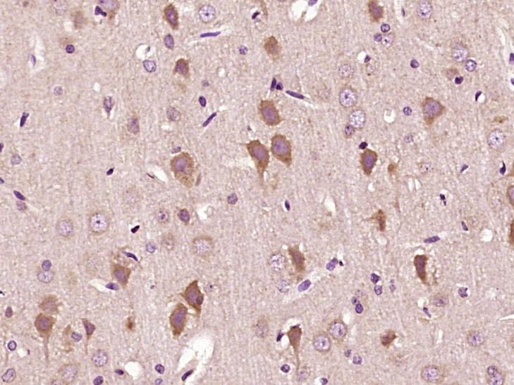 Paraformaldehyde-fixed, paraffin embedded Rat brain; Antigen retrieval by boiling in sodium citrate buffer (pH6.0) for 15min; Block endogenous peroxidase by 3% hydrogen peroxide for 20 minutes; Blocking buffer (normal goat serum) at 37°C for 30min; Antibody incubation with Mitofilin/IMMT Polyclonal Antibody, Unconjugated (bs-1824R) at 1:400 overnight at 4°C, DAB staining.
