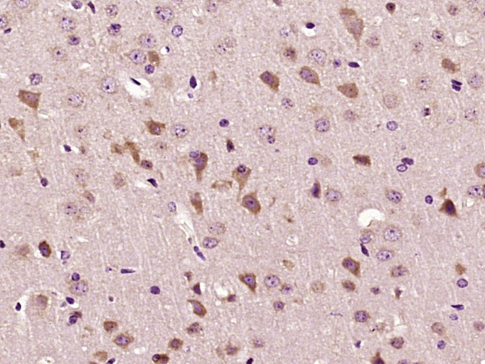 Paraformaldehyde-fixed, paraffin embedded Mouse brain; Antigen retrieval by boiling in sodium citrate buffer (pH6.0) for 15min; Block endogenous peroxidase by 3% hydrogen peroxide for 20 minutes; Blocking buffer (normal goat serum) at 37°C for 30min; Antibody incubation with Mitofilin/IMMT Polyclonal Antibody, Unconjugated (bs-1824R) at 1:400 overnight at 4°C, DAB staining.