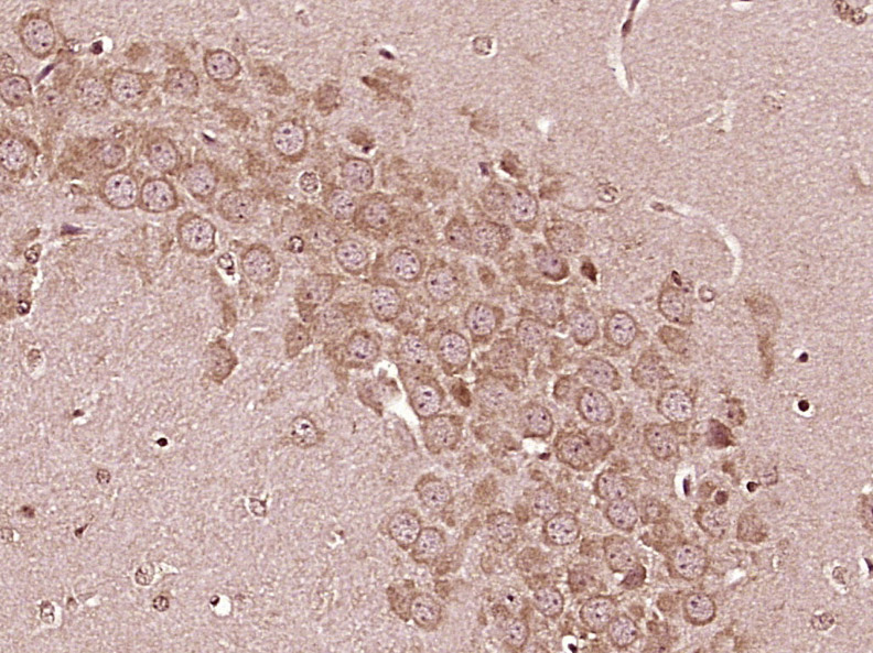 Paraformaldehyde-fixed, paraffin embedded Mouse brain; Antigen retrieval by boiling in sodium citrate buffer (pH6.0) for 15min; Block endogenous peroxidase by 3% hydrogen peroxide for 20 minutes; Blocking buffer (normal goat serum) at 37°C for 30min; Antibody incubation with IL-6R alpha Polyclonal Antibody, Unconjugated (bs-1805R) at 1:400 overnight at 4°C, DAB staining. Paraformaldehyde-fixed, paraffin embedded Mouse brain; Antigen retrieval by boiling in sodium citrate buffer (pH6.0) for 15min; Block endogenous peroxidase by 3% hydrogen peroxide for 20 minutes; Blocking buffer (normal goat serum) at 37°C for 30min; Antibody incubation with IL-6R alpha Polyclonal Antibody, Unconjugated (bs-1805R) at 1:400 overnight at 4°C, DAB staining.