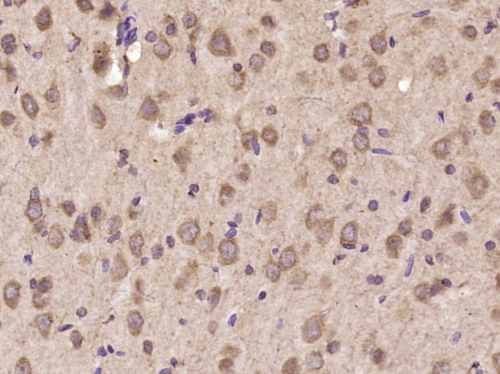 Paraformaldehyde-fixed, paraffin embedded Rat brain; Antigen retrieval by boiling in sodium citrate buffer (pH6.0) for 15min; Block endogenous peroxidase by 3% hydrogen peroxide for 20 minutes; Blocking buffer (normal goat serum) at 37°C for 30min; Antibody incubation with IL-11 Polyclonal Antibody, Unconjugated (bs-1827R) at 1:400 overnight at 4°C, DAB staining.