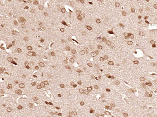 Paraformaldehyde-fixed, paraffin embedded Mouse brain; Antigen retrieval by boiling in sodium citrate buffer (pH6.0) for 15min; Block endogenous peroxidase by 3% hydrogen peroxide for 20 minutes; Blocking buffer (normal goat serum) at 37°C for 30min; Antibody incubation with PRCP Polyclonal Antibody, Unconjugated (bs-1873R) at 1:400 overnight at 4°C, DAB staining.
