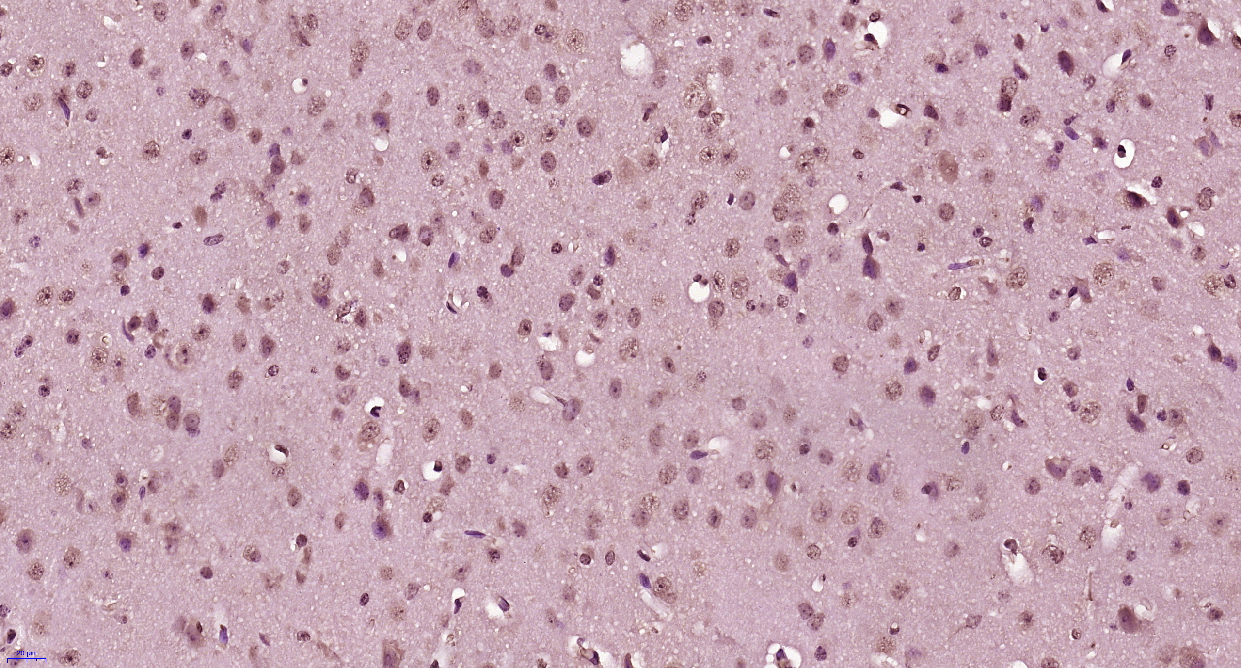 Paraformaldehyde-fixed, paraffin embedded Mouse brain; Antigen retrieval by boiling in sodium citrate buffer (pH6.0) for 15min; Block endogenous peroxidase by 3% hydrogen peroxide for 20 minutes; Blocking buffer (normal goat serum) at 37°C for 30min; Antibody incubation with ACCN2 Polyclonal Antibody, Unconjugated (bs-12128R) at 1:400 overnight at 4°C, DAB staining. Paraformaldehyde-fixed, paraffin embedded Mouse brain; Antigen retrieval by boiling in sodium citrate buffer (pH6.0) for 15min; Block endogenous peroxidase by 3% hydrogen peroxide for 20 minutes; Blocking buffer (normal goat serum) at 37°C for 30min; Antibody incubation with ACCN2 Polyclonal Antibody, Unconjugated (bs-12128R) at 1:400 overnight at 4°C, DAB staining.