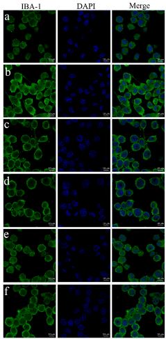 BV-microglia stained with AIF1 Polyclonal Antibody (bs-1363R) at 1:100 dilution. AIF1 expression (green) in activated BV-microglia is observed using confocal microscopy. The blue staining represents DAPI. (a) Control; (b) treated with CCL2 (3 ng/mL); (c) CCL2 (3 ng/mL) + l-CDL (3 µM); (d) CCL2 (3 ng/mL) + l-CDL (10 µM); (e) CCL2 (3 ng/mL) + l-CDL (30 µM); (f) CCL2 (3 ng/mL) + RS504393 (10 µM);