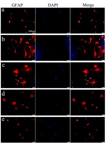 Astrocytes were stained with GFAP polyclonal antibody (bs-0199R). Expression of GFAP expression (red) in activated astrocytes as visualized by fluorescence microscope. The blue staining represents DAPI. (a) control; (b) treated with TNF-α (10 ng/mL); (c) TNF-α (10 ng/mL) + l-CDL (3 μM); (d) TNF-α (10 ng/mL) + l-CDL (10 μM); (e) TNF-α (10 ng/mL) + l-CDL (30 μM).