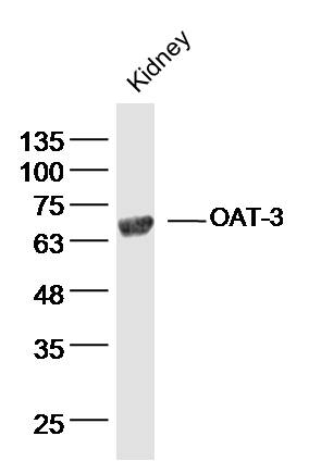 Mouse kidney lysates probed with OAT-3 Polyclonal Antibody, Unconjugated (bs-0609R) at 1:300 dilution and 4˚C overnight incubation. Followed by conjugated secondary antibody incubation at 1:10000 for 60 min at 37˚C.