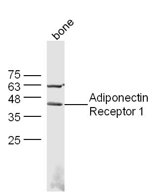 Mouse bone lysates probed with Adiponectin Receptor 1 Polyclonal Antibody, Unconjugated (bs-0610R) at 1:300 dilution and 4˚C overnight incubation. Followed by conjugated secondary antibody incubation at 1:10000 for 60 min at 37˚C.