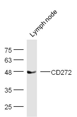 Mouse Lymph node lysates probed with CD272 Polyclonal Antibody, Unconjugated (bs-0624R) at 1:300 dilution and 4˚C overnight incubation. Followed by conjugated secondary antibody incubation at 1:10000 for 60 min at 37˚C.