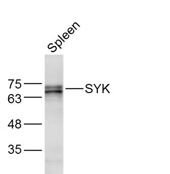 Mouse Spleen lysates probed with SYK Polyclonal Antibody, Unconjugated (bs-0685R) at 1:300 dilution and 4˚C overnight incubation. Followed by conjugated secondary antibody incubation at 1:10000 for 60 min at 37˚C.