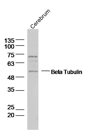 Rat Cerebrum lysates probed with Beta Tubulin Polyclonal Antibody, Unconjugated (bs-0715R) at 1:1000 dilution and 4˚C overnight incubation. Followed by conjugated secondary antibody incubation at 1:10000 for 60 min at 37˚C.