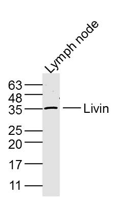 Mouse Lymph node lysates probed with Livin Polyclonal Antibody, Unconjugated (bs-0738R) at 1:300 dilution and 4˚C overnight incubation. Followed by conjugated secondary antibody incubation at 1:10000 for 60 min at 37˚C.