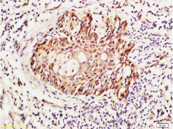 Formalin-fixed and paraffin embedded human skin labeled with Anti-RhoA Polyclonal Antibody (bs-1180R), Unconjugated 1:400 followed by conjugation to the secondary antibody and DAB staining