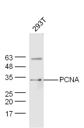 293T lysates probed with PCNA Polyclonal Antibody, Unconjugated (bs-0754R) at 1:300 dilution and 4˚C overnight incubation. Followed by conjugated secondary antibody incubation at 1:10000 for 60 min at 37˚C.