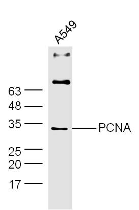 A549 lysates probed with PCNA Polyclonal Antibody, Unconjugated (bs-0754R) at 1:300 dilution and 4˚C overnight incubation. Followed by conjugated secondary antibody incubation at 1:10000 for 60 min at 37˚C.