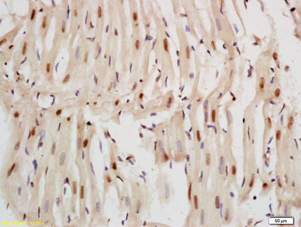 Formalin-fixed and paraffin embedded rat heart labeled with Anti-Nkx2.5/Cardiac-specific homeobox 1 Polyclonal Antibody, Unconjugated (bs-2054R) at 1:200, followed by conjugation to the secondary antibody and DAB staining