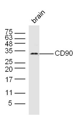 Mouse brain lysates probed with CD90 Polyclonal Antibody, Unconjugated (bs-0778R) at 1:300 dilution and 4˚C overnight incubation. Followed by conjugated secondary antibody incubation at 1:10000 for 60 min at 37˚C.