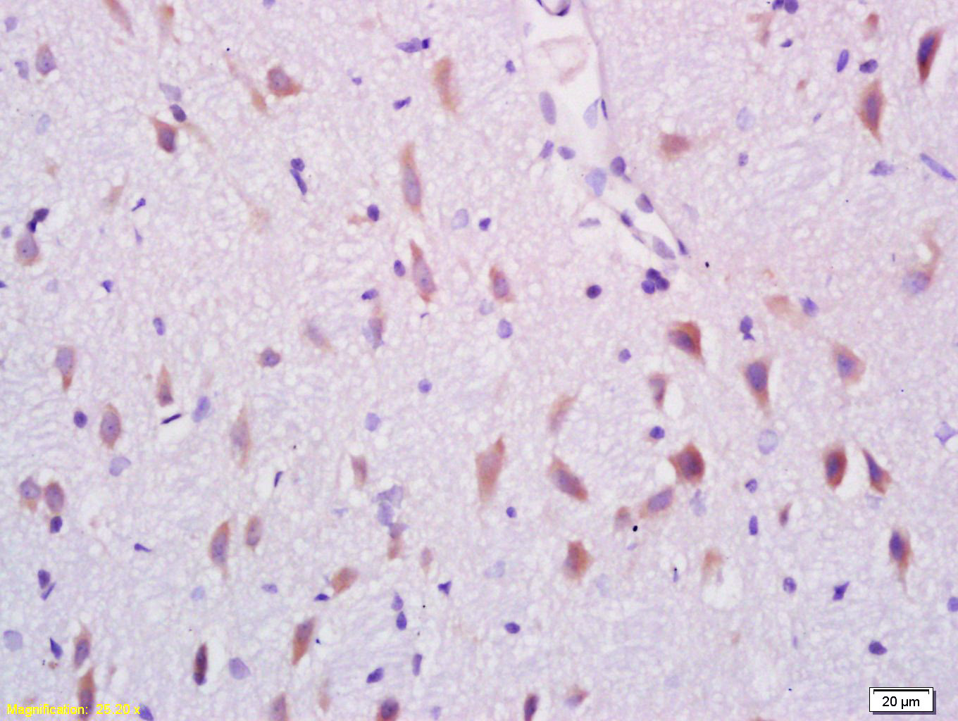 Paraformaldehyde-fixed, paraffin embedded Rat brain; Antigen retrieval by boiling in sodium citrate buffer (pH6.0) for 15min; Block endogenous peroxidase by 3% hydrogen peroxide for 20 minutes; Blocking buffer (normal goat serum) at 37°C for 30min; Antibody incubation with ARHGAP17 Polyclonal Antibody, Unconjugated (bs-2304R) at 1:200 overnight at 4°C, DAB staining.