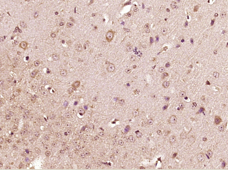 Paraformaldehyde-fixed, paraffin embedded Mouse brain; Antigen retrieval by boiling in sodium citrate buffer (pH6.0) for 15min; Block endogenous peroxidase by 3% hydrogen peroxide for 20 minutes; Blocking buffer (normal goat serum) at 37°C for 30min; Antibody incubation with Apelin Polyclonal Antibody, Unconjugated (bs-2425R) at 1:400 overnight at 4°C, followed by secondary antibody, DAB, and counter-staining.