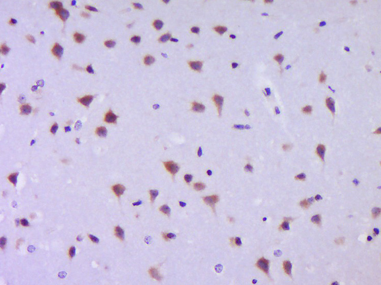 Paraformaldehyde-fixed, paraffin embedded Mouse brain; Antigen retrieval by boiling in sodium citrate buffer (pH6.0) for 15min; Block endogenous peroxidase by 3% hydrogen peroxide for 20 minutes; Blocking buffer (normal goat serum) at 37°C for 30min; Antibody incubation with JNK1+2+3 Polyclonal Antibody, Unconjugated (bs-2592R) at 1:400 overnight at 4°C, DAB staining.