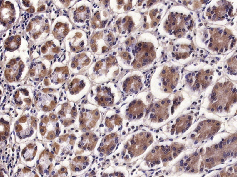 Paraformaldehyde-fixed, paraffin embedded Human stomach; Antigen retrieval by boiling in sodium citrate buffer (pH6.0) for 15min; Block endogenous peroxidase by 3% hydrogen peroxide for 20 minutes; Blocking buffer (normal goat serum) at 37°C for 30min; Antibody incubation with IL-17B Polyclonal Antibody, Unconjugated (bs-2609R) at 1:400 overnight at 4°C, DAB staining. Paraformaldehyde-fixed, paraffin embedded Human stomach; Antigen retrieval by boiling in sodium citrate buffer (pH6.0) for 15min; Block endogenous peroxidase by 3% hydrogen peroxide for 20 minutes; Blocking buffer (normal goat serum) at 37°C for 30min; Antibody incubation with IL-17B Polyclonal Antibody, Unconjugated (bs-2609R) at 1:400 overnight at 4°C, DAB staining.