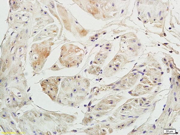 Formalin-fixed and paraffin embedded rabbit bladder labeled with Anti-P2RX3/ATP receptor Polyclonal Antibody, Unconjugated (bs-4249R) at 1:200 followed by conjugation to the secondary antibody and DAB staining.