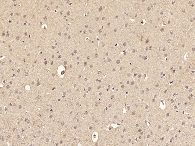 Paraformaldehyde-fixed, paraffin embedded Rat brain; Antigen retrieval by boiling in sodium citrate buffer (pH6.0) for 15min; Block endogenous peroxidase by 3% hydrogen peroxide for 20 minutes; Blocking buffer (normal goat serum) at 37°C for 30min; Antibody incubation with FoxO3a (Ser318 + Ser321) Polyclonal Antibody, Unconjugated (bs-3138R) at 1:400 overnight at 4°C, DAB staining. Paraformaldehyde-fixed, paraffin embedded Rat brain; Antigen retrieval by boiling in sodium citrate buffer (pH6.0) for 15min; Block endogenous peroxidase by 3% hydrogen peroxide for 20 minutes; Blocking buffer (normal goat serum) at 37°C for 30min; Antibody incubation with FoxO3a (Ser318 + Ser321) Polyclonal Antibody, Unconjugated (bs-3138R) at 1:400 overnight at 4°C, DAB staining.
