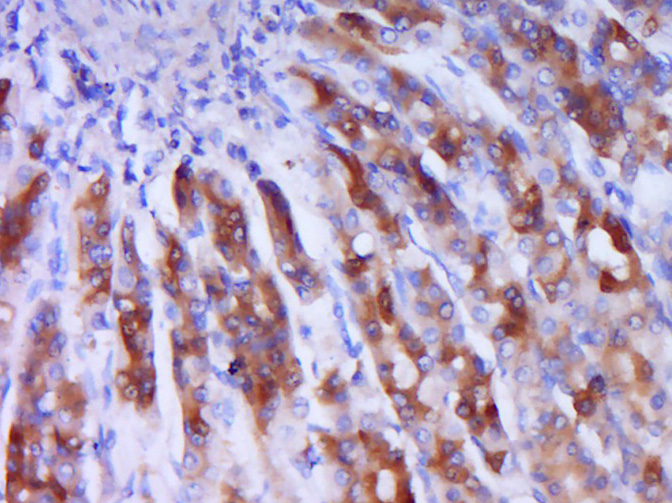 Paraformaldehyde-fixed, paraffin embedded Rat stomach; Antigen retrieval by boiling in sodium citrate buffer (pH6.0) for 15min; Block endogenous peroxidase by 3% hydrogen peroxide for 20 minutes; Blocking buffer (normal goat serum) at 37°C for 30min; Antibody incubation with IRS1(Ser1101) Polyclonal Antibody, Unconjugated (bs-3197R) at 1:400 overnight at 4°C, DAB staining. Paraformaldehyde-fixed, paraffin embedded Rat stomach; Antigen retrieval by boiling in sodium citrate buffer (pH6.0) for 15min; Block endogenous peroxidase by 3% hydrogen peroxide for 20 minutes; Blocking buffer (normal goat serum) at 37°C for 30min; Antibody incubation with IRS1(Ser1101) Polyclonal Antibody, Unconjugated (bs-3197R) at 1:400 overnight at 4°C, DAB staining.