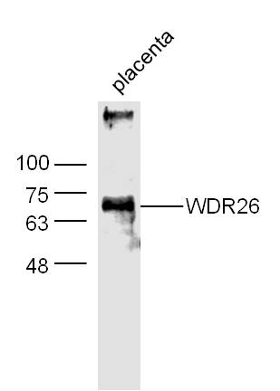 Mouse Placenta lysates probed with WDR26 Polyclonal Antibody, Unconjugated (bs-0932R) at 1:300 dilution and 4˚C overnight incubation. Followed by conjugated secondary antibody incubation at 1:10000 for 60 min at 37˚C.