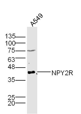 A549 lysates probed with NPY2R Polyclonal Antibody, Unconjugated (bs-0937R) at 1:300 dilution and 4˚C overnight incubation. Followed by conjugated secondary antibody incubation at 1:10000 for 60 min at 37˚C.