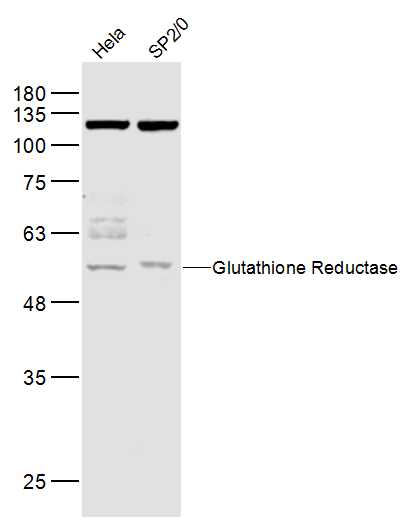 Lane 1: Hela lysates; Lane 2: Sp2/0 lysates probed with Glutathione Reductase Polyclonal Antibody, Unconjugated (bs-0837R) at 1:1000 dilution and 4˚C overnight incubation. Followed by conjugated secondary antibody incubation at 1:10000 for 60 min at 37˚C.