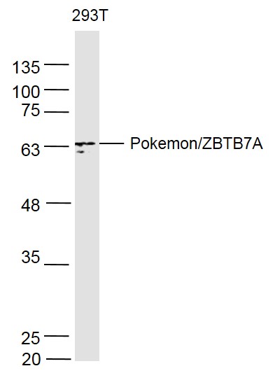 293T lysates probed with PokemonZBTB7A Polyclonal Antibody, Unconjugated (bs-0891R) at 1:500 dilution and 4˚C overnight incubation. Followed by conjugated secondary antibody incubation at 1:10000 for 60 min at 37˚C.