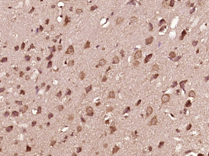 Paraformaldehyde-fixed, paraffin embedded Rat brain; Antigen retrieval by boiling in sodium citrate buffer (pH6.0) for 15min; Block endogenous peroxidase by 3% hydrogen peroxide for 20 minutes; Blocking buffer (normal goat serum) at 37°C for 30min; Antibody incubation with MEK1(Thr286) Polyclonal Antibody, Unconjugated (bs-3269R) at 1:400 overnight at 4°C, DAB staining.