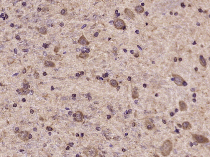 Paraformaldehyde-fixed, paraffin embedded rat brain; Antigen retrieval by boiling in sodium citrate buffer (pH6.0) for 15min; Block endogenous peroxidase by 3% hydrogen peroxide for 20 minutes; Blocking buffer (normal goat serum) at 37°C for 30min; Antibody incubation with Tyk2(Tyr1054 + Tyr1055) Polyclonal Antibody, Unconjugated (bs-3437R) at 1:400 overnight at 4°C, DAB staining. Paraformaldehyde-fixed, paraffin embedded rat brain; Antigen retrieval by boiling in sodium citrate buffer (pH6.0) for 15min; Block endogenous peroxidase by 3% hydrogen peroxide for 20 minutes; Blocking buffer (normal goat serum) at 37°C for 30min; Antibody incubation with Tyk2(Tyr1054 + Tyr1055) Polyclonal Antibody, Unconjugated (bs-3437R) at 1:400 overnight at 4°C, DAB staining.