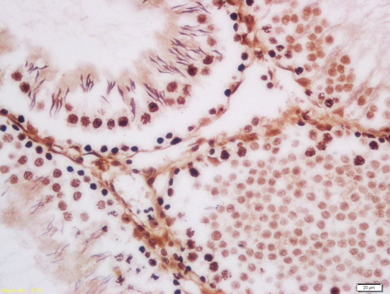 Paraformaldehyde-fixed, paraffin embedded rat testis; Antigen retrieval by boiling in sodium citrate buffer (pH6.0) for 15min; Block endogenous peroxidase by 3% hydrogen peroxide for 20 minutes; Blocking buffer (normal goat serum) at 37°C for 30min; Antibody incubation with TLK1 Polyclonal Antibody, Unconjugated (bs-3583R) at 1:200 overnight at 4°C, DAB staining.