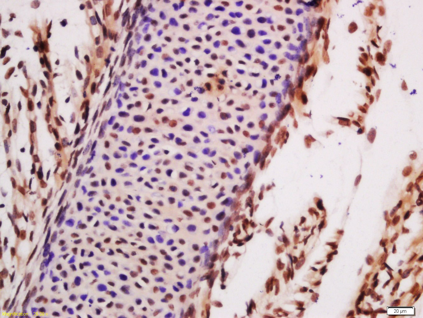 Paraformaldehyde-fixed, paraffin embedded mouse embryo; Antigen retrieval by boiling in sodium citrate buffer (pH6.0) for 15min; Block endogenous peroxidase by 3% hydrogen peroxide for 20 minutes; Blocking buffer (normal goat serum) at 37°C for 30min; Antibody incubation with TLK1 Polyclonal Antibody, Unconjugated (bs-3583R) at 1:200 overnight at 4°C, DAB staining.