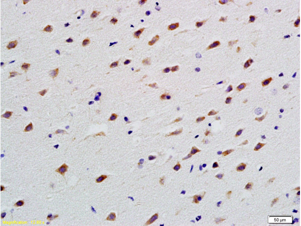 Formalin-fixed and paraffin embedded rat brain labeled with Anti-TUBB3 Polyclonal Antibody, Unconjugated (bs-4512R) at 1:200 followed by conjugation to the secondary antibody and DAB staining