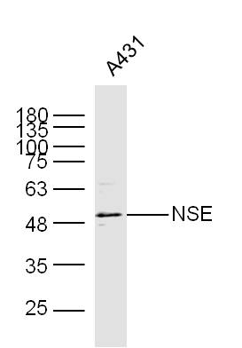 A431 lysates probed with NSE Polyclonal Antibody, Unconjugated (bs-1027R) at 1:300 dilution and 4˚C overnight incubation. Followed by conjugated secondary antibody incubation at 1:10000 for 60 min at 37˚C.