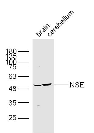 Lane 1: Mouse brain lysates; Lane 2: Mouse cerebellum lysates probed with NSE Polyclonal Antibody, Unconjugated (bs-1027R) at 1:300 dilution and 4˚C overnight incubation. Followed by conjugated secondary antibody incubation at 1:10000 for 60 min at 37˚C. 