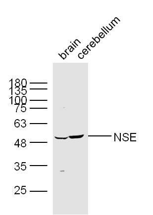 Nse Polyclonal Antibody Bioss