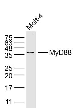 Molt-4 lysates probed with MyD88 Polyclonal Antibody, Unconjugated (bs-1047R) at 1:300 dilution and 4˚C overnight incubation. Followed by conjugated secondary antibody incubation at 1:10000 for 60 min at 37˚C.