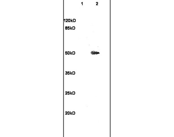 L1 rat brain lysates L2 rat kidney lysates probed with Anti TUBB3 Polyclonal Antibody, Unconjugated (bs-4512R) at 1:200 overnight at 4˚C. Followed by conjugation to secondary antibody (bs-0295G-HRP) at 1:3000 for 90 min at 37˚C. Predicted band 50kD. Observed band size:50kD.\n