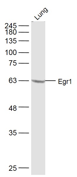 Mouse Lung lysates probed with Egr1 Polyclonal Antibody, Unconjugated (bs-1076R) at 1:500 dilution and 4˚C overnight incubation. Followed by conjugated secondary antibody incubation at 1:10000 for 60 min at 37˚C.