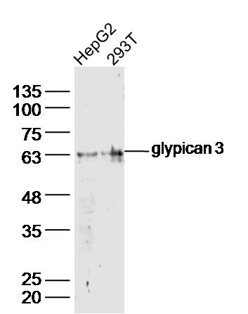 Lane 1: HepG2 lysates; Lane 2: 293T lysates probed with glypican 3 Polyclonal Antibody, Unconjugated (bs-1112R) at 1:300 dilution and 4˚C overnight incubation. Followed by conjugated secondary antibody incubation at 1:10000 for 60 min at 37˚C. 