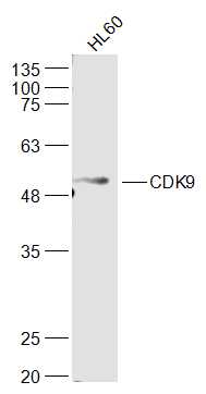 Human HL-60 lysates probed with CDK9 Polyclonal Antibody, Unconjugated (bs-1388R) at 1:500 dilution and 4˚C overnight incubation. Followed by conjugated secondary antibody incubation at 1:10000 for 60 min at 37˚C.