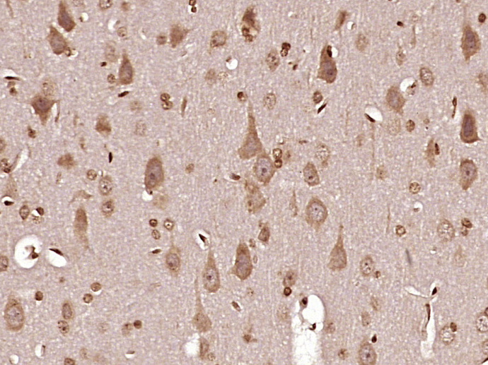 Paraformaldehyde-fixed, paraffin embedded Rat brain; Antigen retrieval by boiling in sodium citrate buffer (pH6.0) for 15min; Block endogenous peroxidase by 3% hydrogen peroxide for 20 minutes; Blocking buffer (normal goat serum) at 37°C for 30min; Antibody incubation with MT-ND6 Polyclonal Antibody, Unconjugated (bs-3955R) at 1:400 overnight at 4°C, DAB staining.
