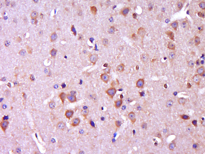 Paraformaldehyde-fixed, paraffin embedded mouse brain; Antigen retrieval by boiling in sodium citrate buffer (pH6.0) for 15min; Block endogenous peroxidase by 3% hydrogen peroxide for 20 minutes; Blocking buffer (normal goat serum) at 37°C for 30min; Antibody incubation with CTNNBIP1 Polyclonal Antibody, Unconjugated (bs-4095R) at 1:400 overnight at 4°C, DAB staining.