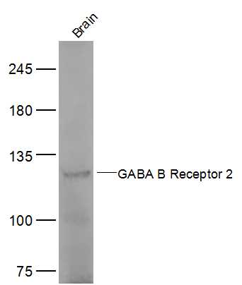 Mouse brain lysates probed with GABA B Receptor 2 Polyclonal Antibody, Unconjugated (bs-1293R) at 1:500 dilution and 4˚C overnight incubation. Followed by conjugated secondary antibody incubation at 1:10000 for 60 min at 37˚C.